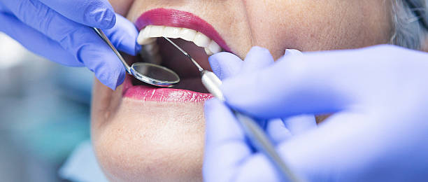 Best Emergency Wisdom Tooth Extraction in Brent, AL