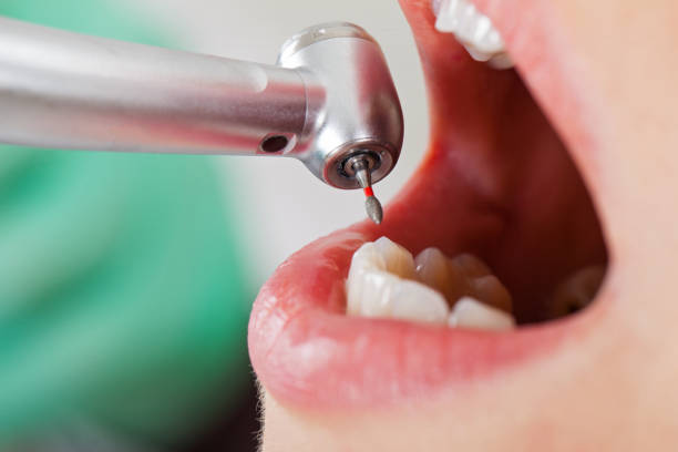 Best Emergency Dental Care for Sports Injuries in Brent, AL